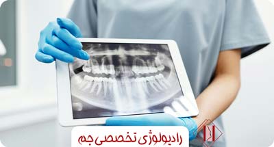 اثر تصویربرداری سه‌بعدی بر کاهش عوارض پس از کاشت ایمپلنت دندانی