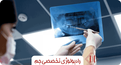 اهمیت بی‌بدیل رادیوگرافی پیش از جراحی‌های فک و صورت