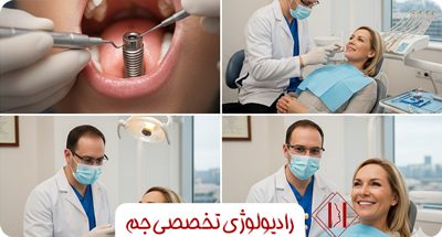 چه رادیوگرافی‌ای برای ایمپلنت دندان مناسب‌تر است؟ | راهنمای کامل انتخاب تصویربرداری دندان