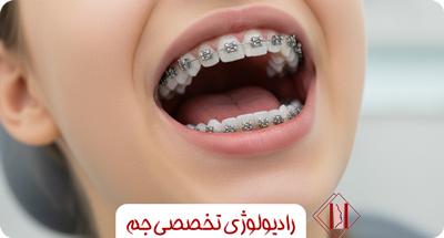 قبل از ارتودنسی چه رادیولوژی‌هایی لازم است؟